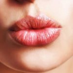 Шарики в губах после гиалуроновой кислоты причины, лечение