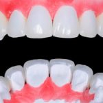 Лучший крем для зубных протезов 2019 года — 6 ТОП рейтинг лучших