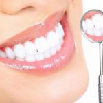 Отбеливаем зубы дома или белоснежная улыбка быстро и дёшево
