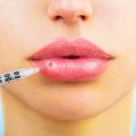 Увеличение губ гиалуроновой кислотой рекомендации по уходу после процедуры